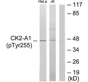 Western Blot - Anti-Casein Kinase II alpha (phospho Tyr255) Antibody (A1192) - Antibodies.com