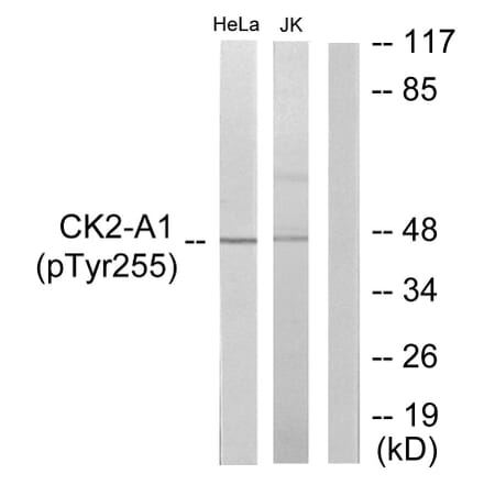 Western Blot - Anti-Casein Kinase II alpha (phospho Tyr255) Antibody (A1192) - Antibodies.com