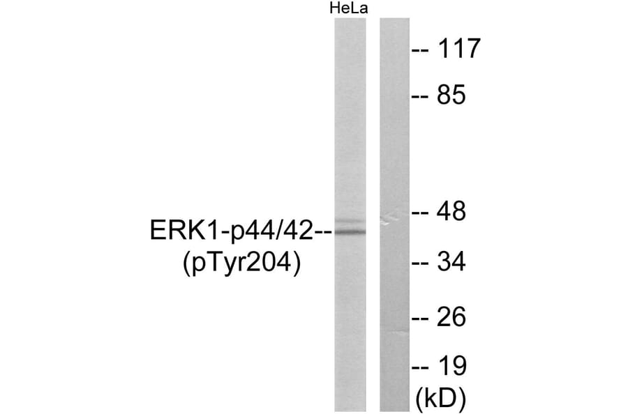 Western Blot - Anti-p44/42 MAP Kinase (phospho Tyr204) Antibody (A7074) - Antibodies.com