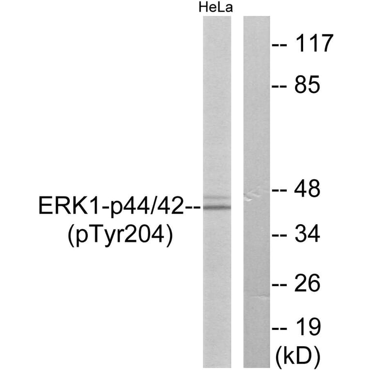 Western Blot - Anti-p44/42 MAP Kinase (phospho Tyr204) Antibody (A7074) - Antibodies.com