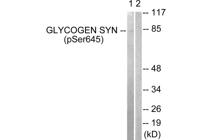 Western Blot - Anti-Glycogen Synthase (phospho Ser645) Antibody (A0431) - Antibodies.com