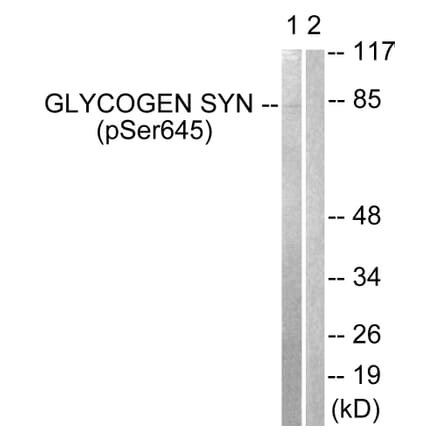 Western Blot - Anti-Glycogen Synthase (phospho Ser645) Antibody (A0431) - Antibodies.com