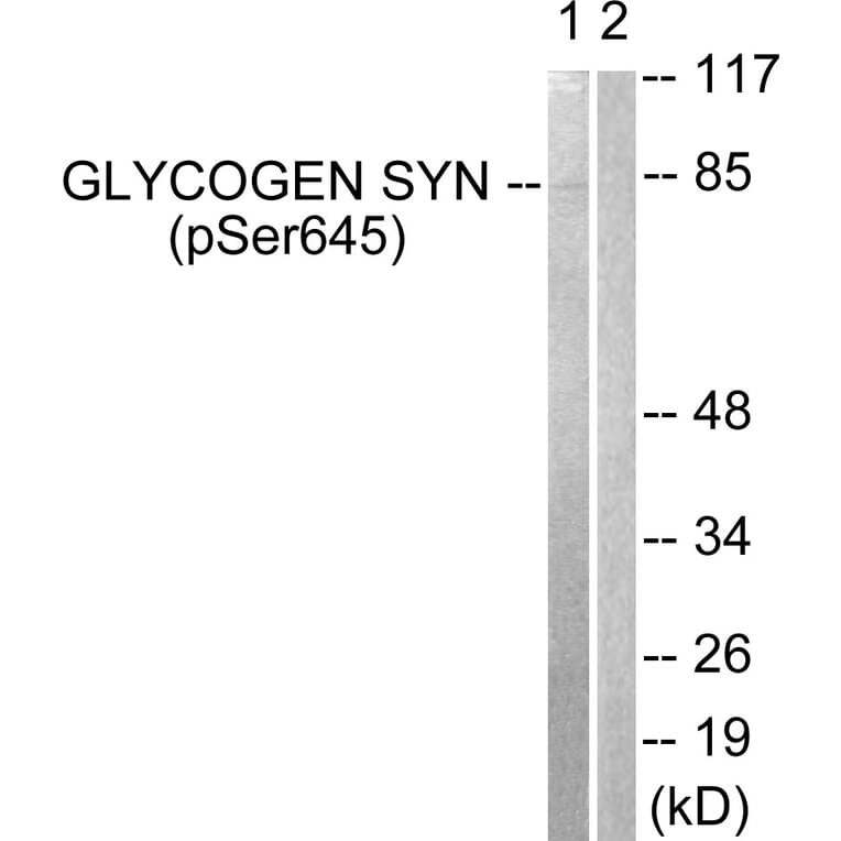 Western Blot - Anti-Glycogen Synthase (phospho Ser645) Antibody (A0431) - Antibodies.com