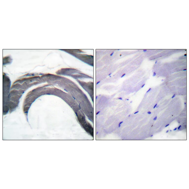 Immunohistochemistry - Anti-Glycogen Synthase (phospho Ser645) Antibody (A0431) - Antibodies.com