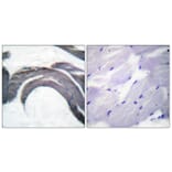 Immunohistochemistry - Anti-Glycogen Synthase (phospho Ser645) Antibody (A0431) - Antibodies.com