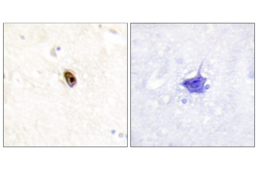 Immunohistochemistry - Anti-Aurora B + C (phospho Thr236 + Thr202) Antibody (A1137) - Antibodies.com