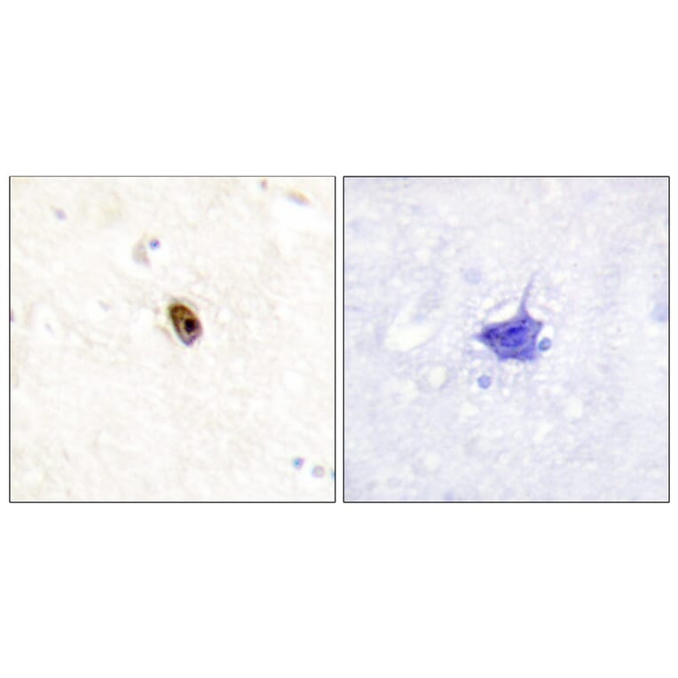 Immunohistochemistry - Anti-Aurora B + C (phospho Thr236 + Thr202) Antibody (A1137) - Antibodies.com