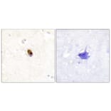 Immunohistochemistry - Anti-Aurora B + C (phospho Thr236 + Thr202) Antibody (A1137) - Antibodies.com