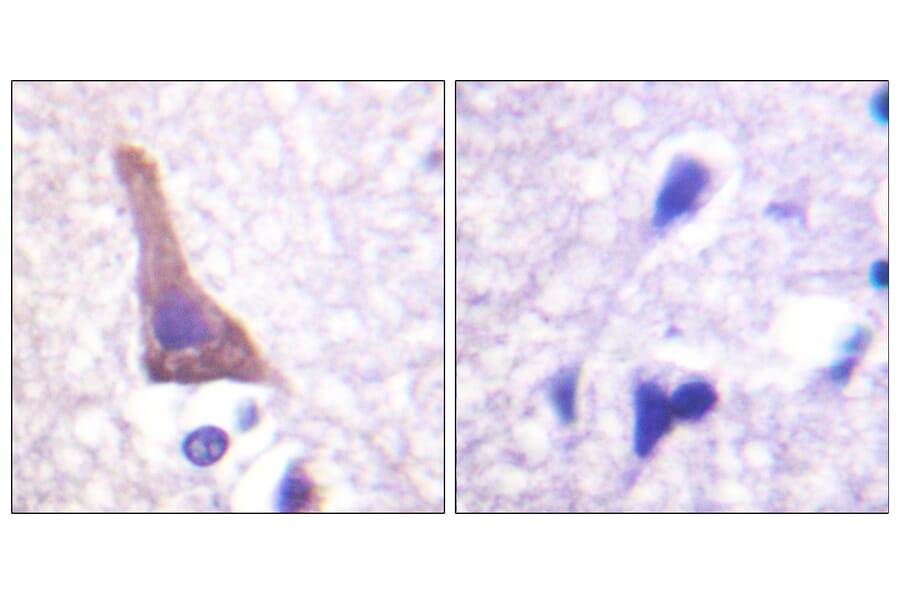 Immunohistochemistry - Anti-Adrenergic Receptor beta2 (phospho Ser346) Antibody (A1131) - Antibodies.com