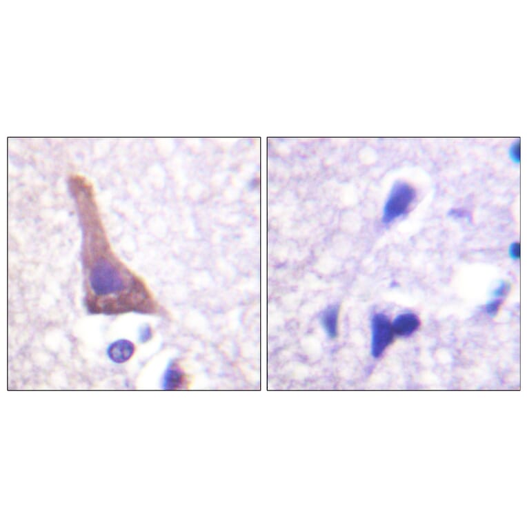 Immunohistochemistry - Anti-Adrenergic Receptor beta2 (phospho Ser346) Antibody (A1131) - Antibodies.com