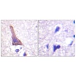 Immunohistochemistry - Anti-Adrenergic Receptor beta2 (phospho Ser346) Antibody (A1131) - Antibodies.com