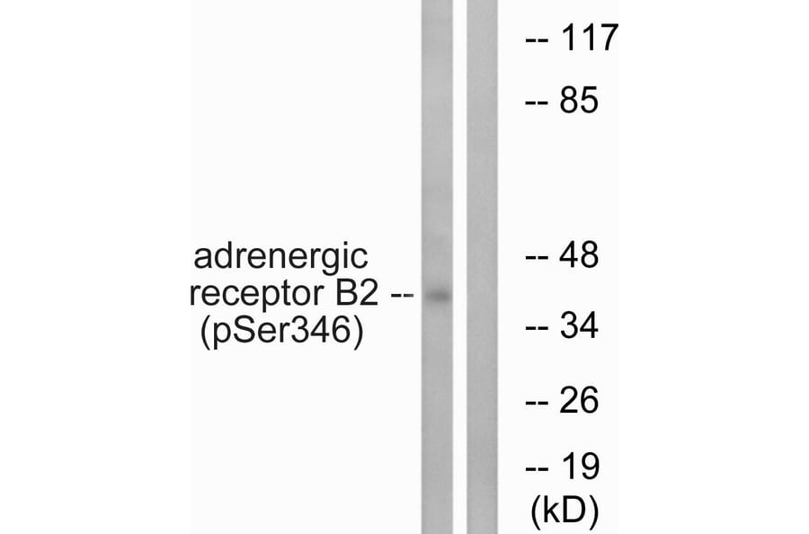 Western Blot - Anti-Adrenergic Receptor beta2 (phospho Ser346) Antibody (A1131) - Antibodies.com