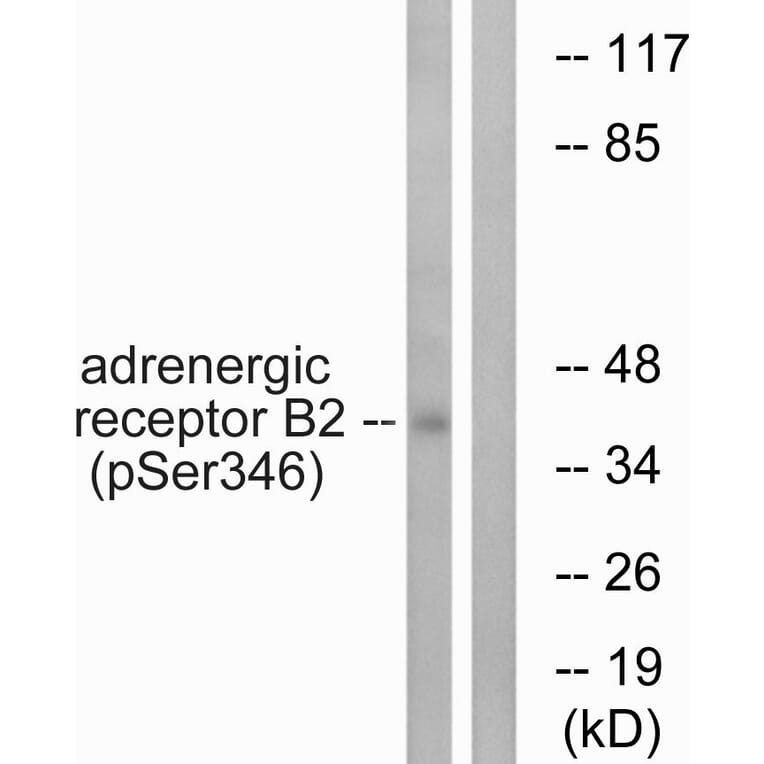 Western Blot - Anti-Adrenergic Receptor beta2 (phospho Ser346) Antibody (A1131) - Antibodies.com