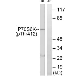 Western Blot - Anti-p70 S6 Kinase (phospho Thr389) Antibody (A0533) - Antibodies.com