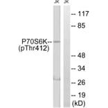 Western Blot - Anti-p70 S6 Kinase (phospho Thr389) Antibody (A0533) - Antibodies.com
