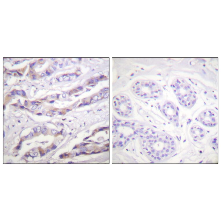 Immunohistochemistry - Anti-p70 S6 Kinase (phospho Thr389) Antibody (A0533) - Antibodies.com