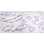 Immunohistochemistry - Anti-p70 S6 Kinase (phospho Thr389) Antibody (A0533) - Antibodies.com