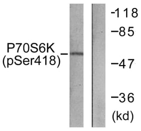 Western Blot - Anti-p70 S6 Kinase (phospho Ser418) Antibody (A0534) - Antibodies.com