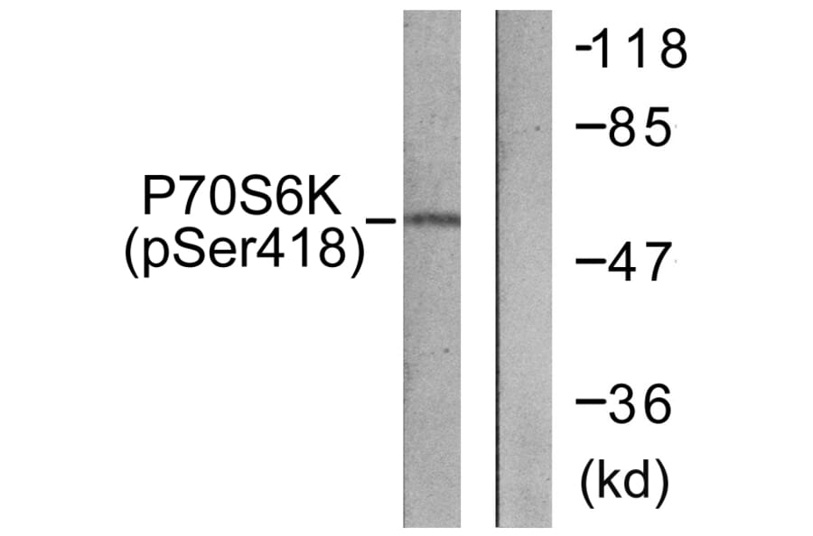 Western Blot - Anti-p70 S6 Kinase (phospho Ser418) Antibody (A0534) - Antibodies.com