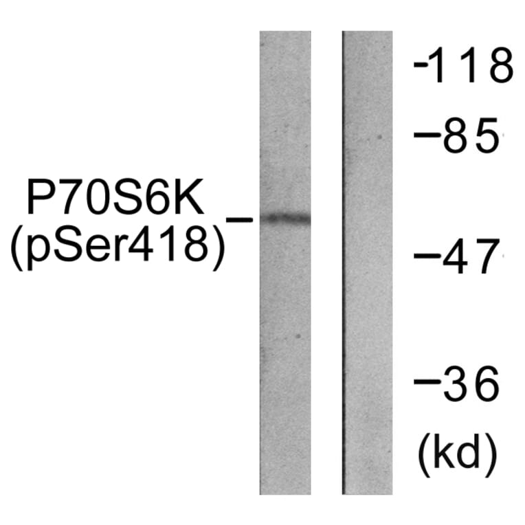 Western Blot - Anti-p70 S6 Kinase (phospho Ser418) Antibody (A0534) - Antibodies.com