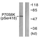 Western Blot - Anti-p70 S6 Kinase (phospho Ser418) Antibody (A0534) - Antibodies.com