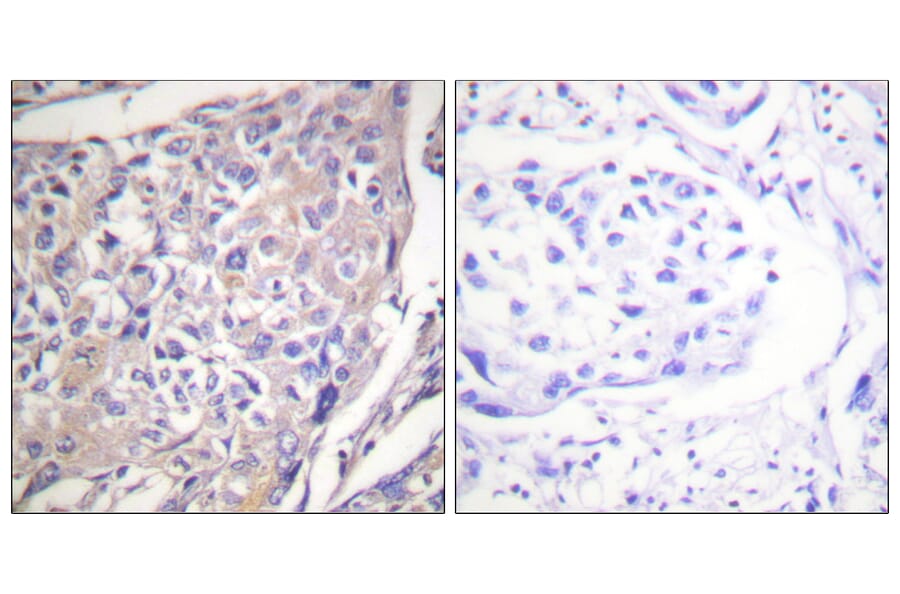 Immunohistochemistry - Anti-p70 S6 Kinase (phospho Ser418) Antibody (A0534) - Antibodies.com