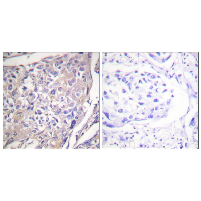 Immunohistochemistry - Anti-p70 S6 Kinase (phospho Ser418) Antibody (A0534) - Antibodies.com