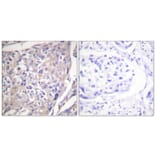 Immunohistochemistry - Anti-p70 S6 Kinase (phospho Ser418) Antibody (A0534) - Antibodies.com