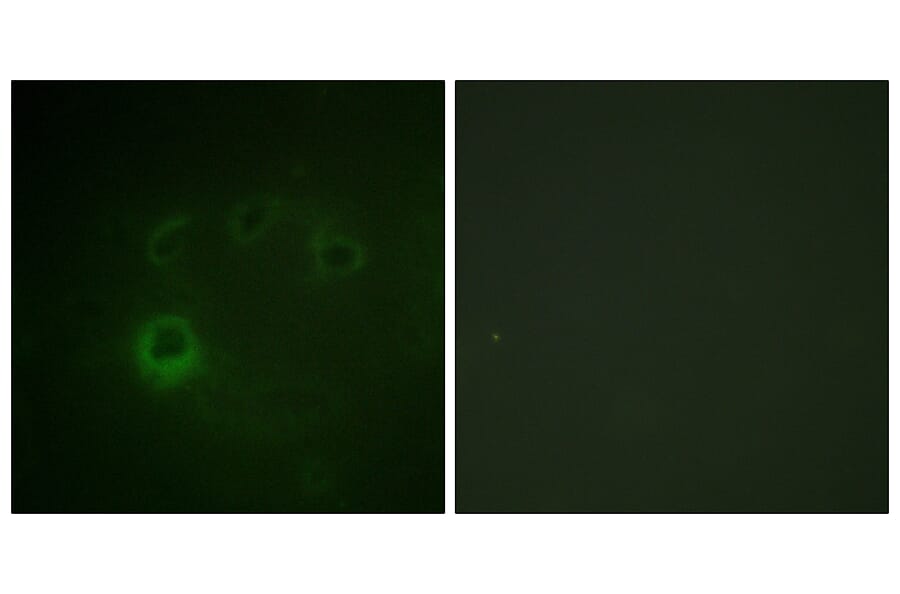 Immunofluorescence - Anti-p70 S6 Kinase (phospho Ser418) Antibody (A0534) - Antibodies.com