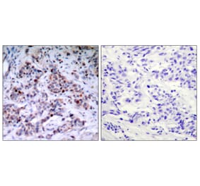Immunohistochemistry - Anti-NF-kappaB p65 (phospho Thr435) Antibody (A7173) - Antibodies.com