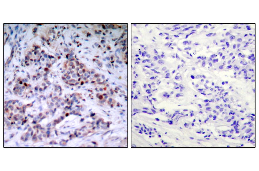 Immunohistochemistry - Anti-NF-kappaB p65 (phospho Thr435) Antibody (A7173) - Antibodies.com