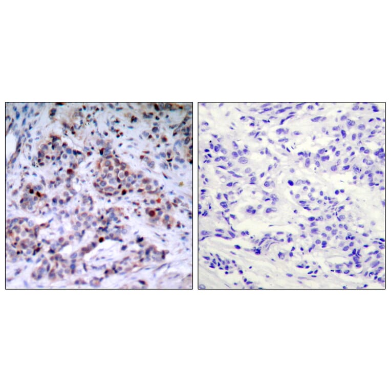 Immunohistochemistry - Anti-NF-kappaB p65 (phospho Thr435) Antibody (A7173) - Antibodies.com