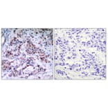 Immunohistochemistry - Anti-NF-kappaB p65 (phospho Thr435) Antibody (A7173) - Antibodies.com