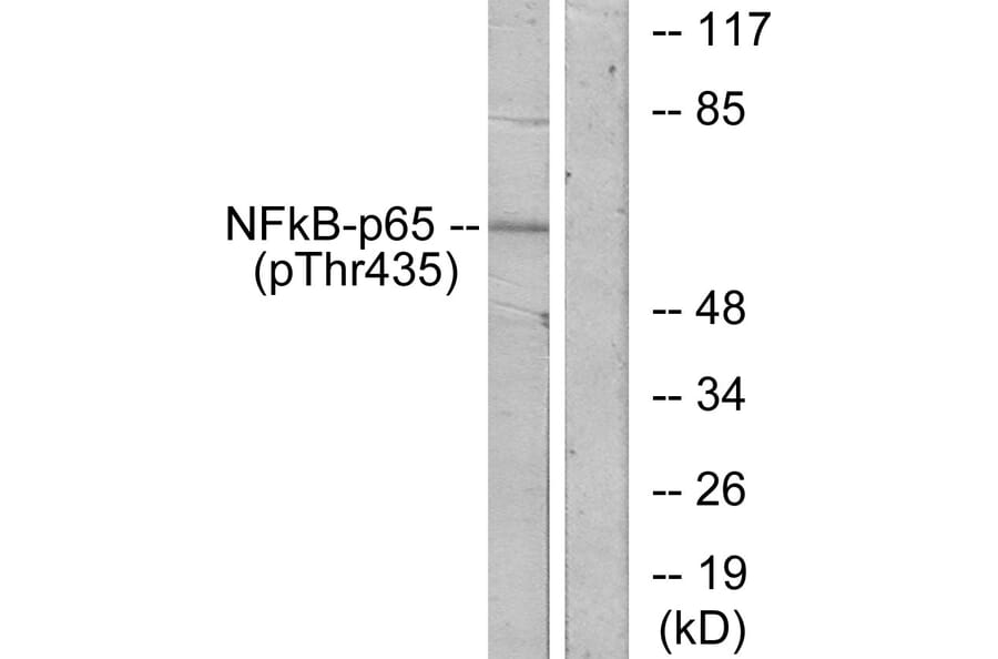 Western Blot - Anti-NF-kappaB p65 (phospho Thr435) Antibody (A7173) - Antibodies.com