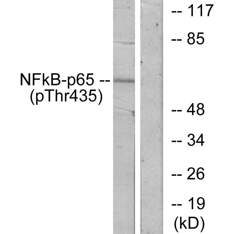 Western Blot - Anti-NF-kappaB p65 (phospho Thr435) Antibody (A7173) - Antibodies.com