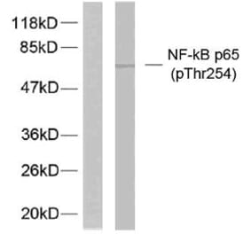 Western Blot - Anti-NF-kappaB p65 (phospho Thr254) Antibody (A7172) - Antibodies.com