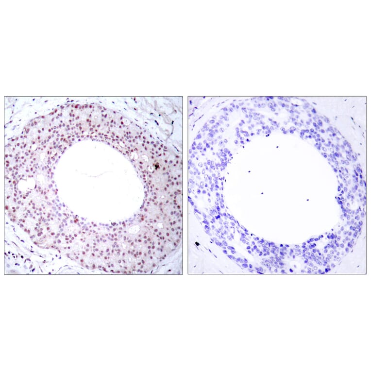 Immunohistochemistry - Anti-NF-kappaB p65 (phospho Thr254) Antibody (A7172) - Antibodies.com