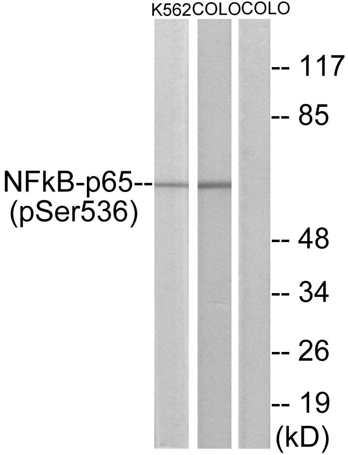 Anti-NF-kappaB P65 (phospho Ser536) Antibody (A93734) | Antibodies.com