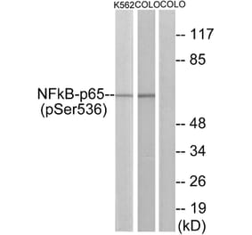 Western Blot - Anti-NF-kappaB p65 (phospho Ser536) Antibody (A7171) - Antibodies.com