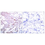 Immunohistochemistry - Anti-NF-kappaB p65 (phospho Ser536) Antibody (A7171) - Antibodies.com