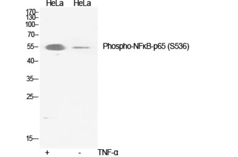Western Blot - Anti-NF-kappaB p65 (phospho Ser536) Antibody (A7171) - Antibodies.com