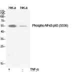 Western Blot - Anti-NF-kappaB p65 (phospho Ser536) Antibody (A7171) - Antibodies.com