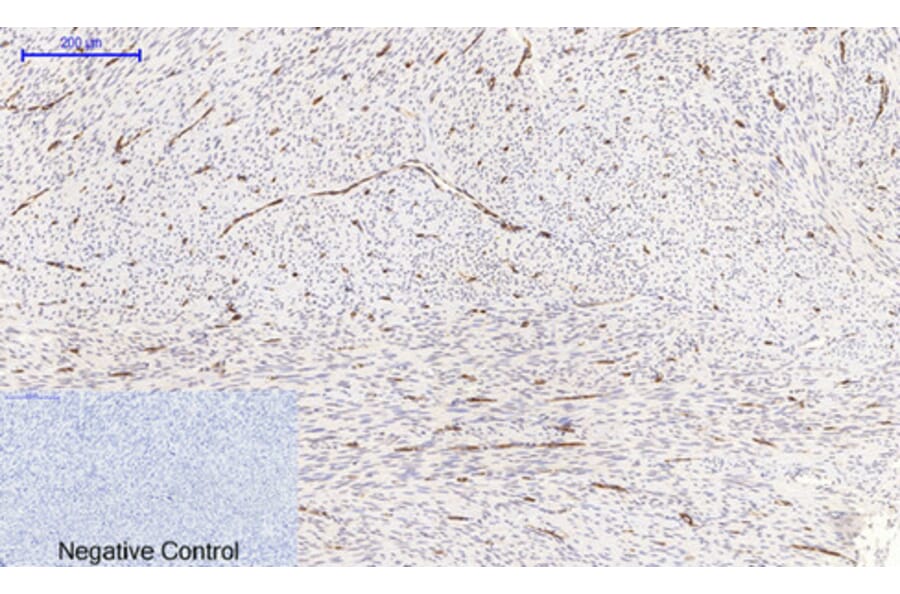 Immunohistochemistry - Anti-NF-kappaB p65 (phospho Ser536) Antibody (A7171) - Antibodies.com