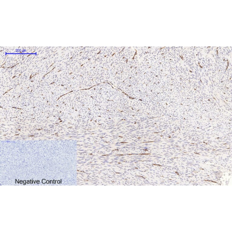 Immunohistochemistry - Anti-NF-kappaB p65 (phospho Ser536) Antibody (A7171) - Antibodies.com