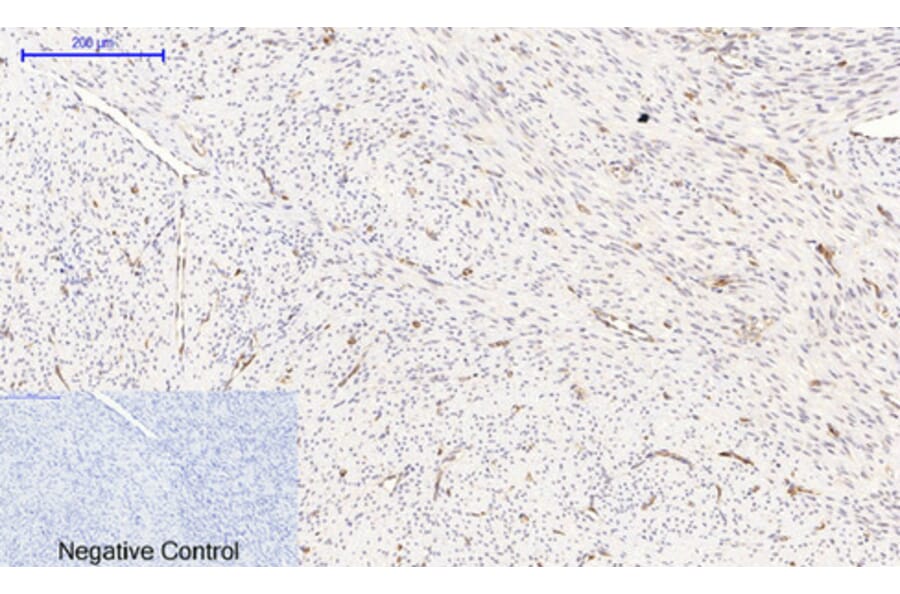 Immunohistochemistry - Anti-NF-kappaB p65 (phospho Ser536) Antibody (A7171) - Antibodies.com
