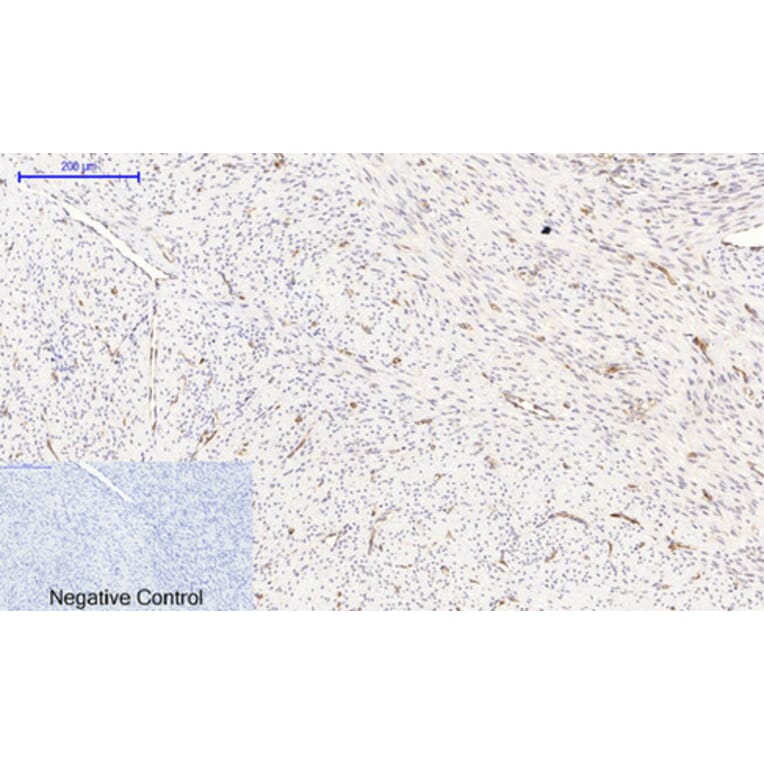 Immunohistochemistry - Anti-NF-kappaB p65 (phospho Ser536) Antibody (A7171) - Antibodies.com