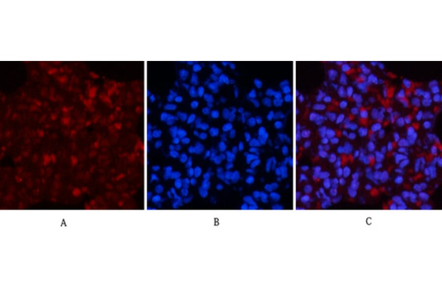 Immunofluorescence - Anti-NF-kappaB p65 (phospho Ser536) Antibody (A7171) - Antibodies.com