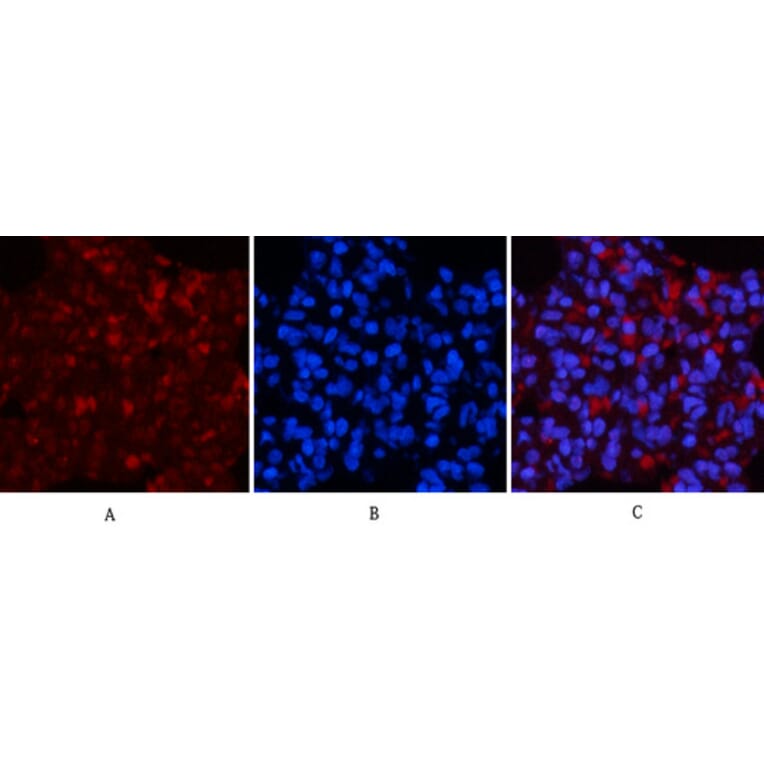 Immunofluorescence - Anti-NF-kappaB p65 (phospho Ser536) Antibody (A7171) - Antibodies.com