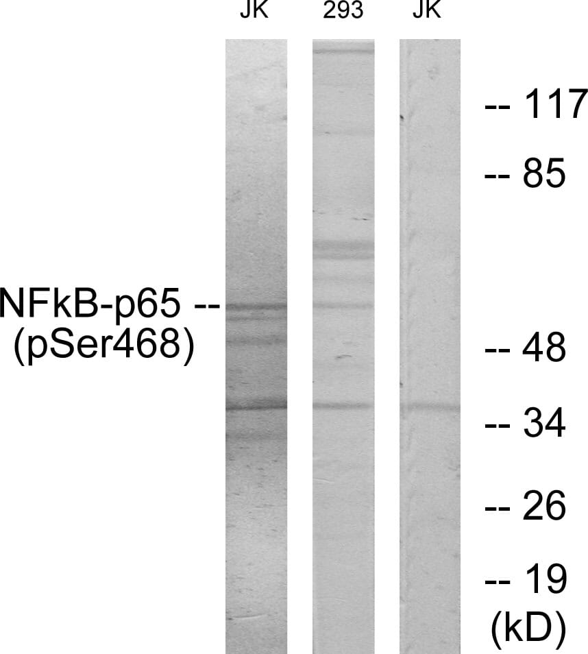 NF-kB P65 Antibodies + "IP" | Antibodies.com