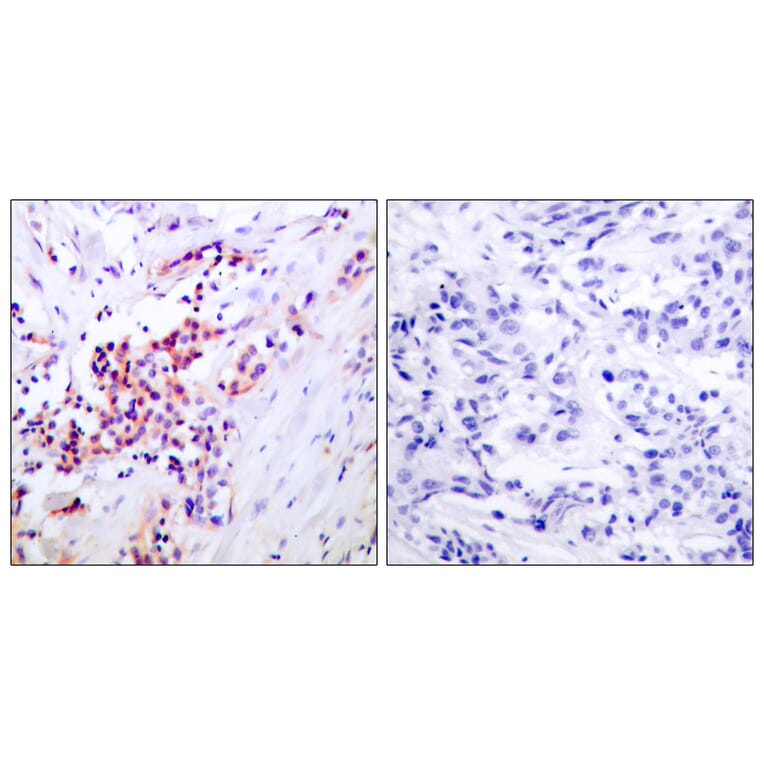 Immunohistochemistry - Anti-NF-kappaB p65 (phospho Ser468) Antibody (A7170) - Antibodies.com